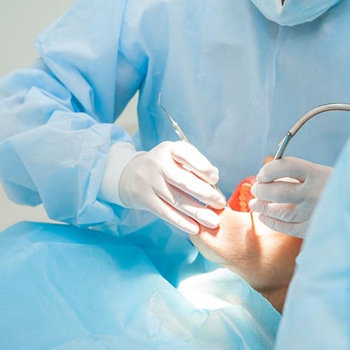 インプラント治療